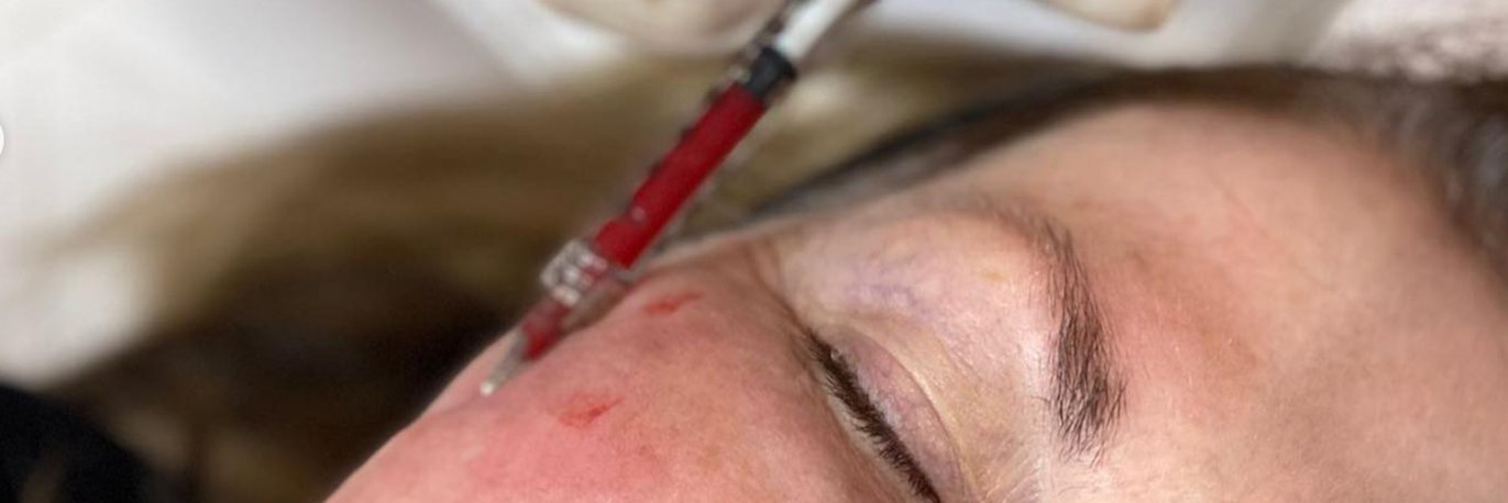 Cosmetic Injections Cairns